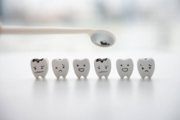 istock Decayed tooth model and good teeth for mirror dentist tool for dental health care concept 1013043930