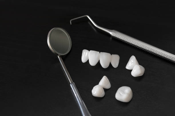 istock Dental tools and zircon dentures - Ceramic veneers - lumineers 1013172944