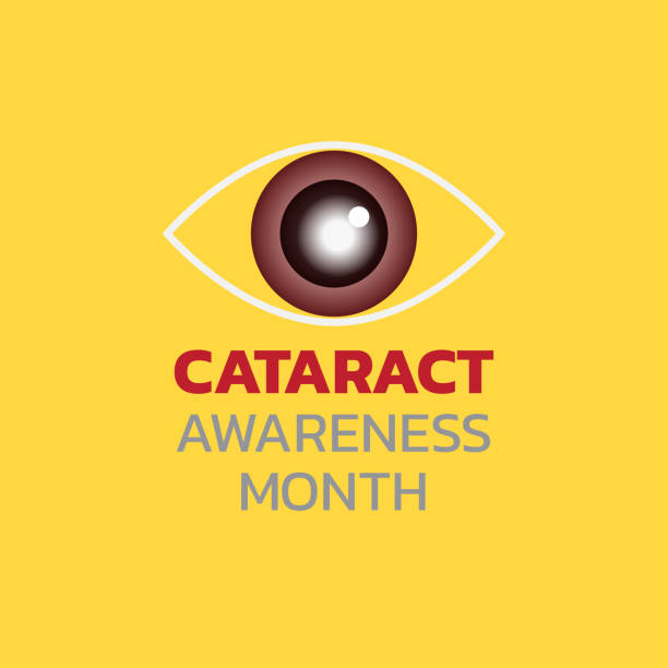 Cataract Awareness Month. Vector illustration. vector art illustration