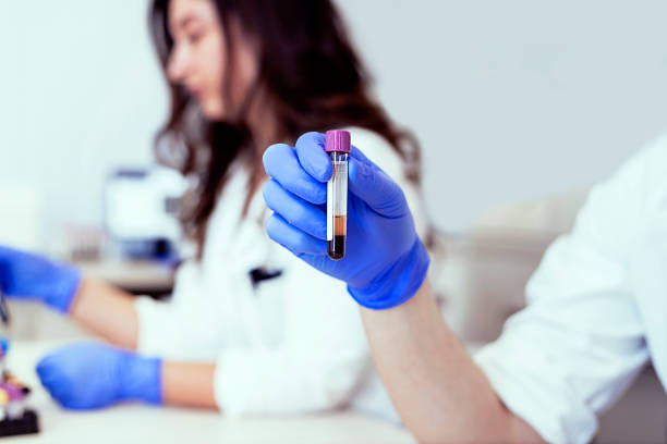 There is something fascinating about science Hand of a Lab Technician Holding Blood Tube Test. Health Care Researchers Working in Life Science Laboratory. Doctor Holds a Blood Sample Tube in His Hand Testing in the Laboratory blood clot photos stock pictures, royalty-free photos & images