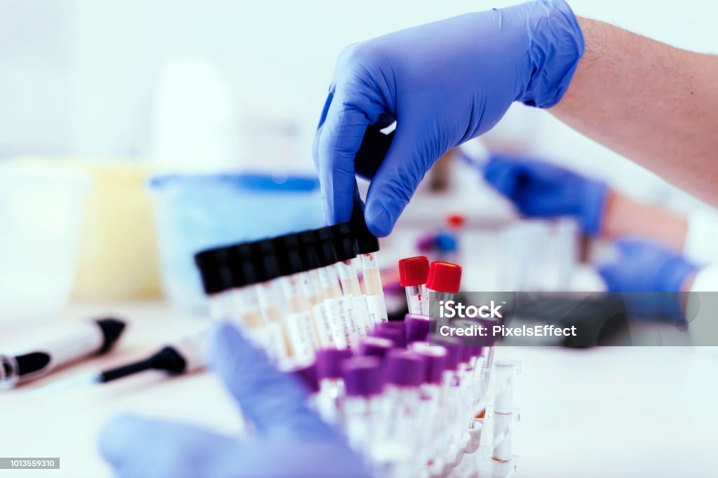 The answers lie in the evidence Scientist Extracting a Rack Tube With Urine Samples. Closeup of a Scientist Working With Urine Samples in Lab. Science, Chemistry, Biology, Medicine and People Concept. Laboratory Stock Photo
