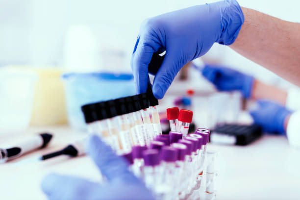 The answers lie in the evidence Scientist Extracting a Rack Tube With Urine Samples. Closeup of a Scientist Working With Urine Samples in Lab. Science, Chemistry, Biology, Medicine and People Concept. specimen holder stock pictures, royalty-free photos & images