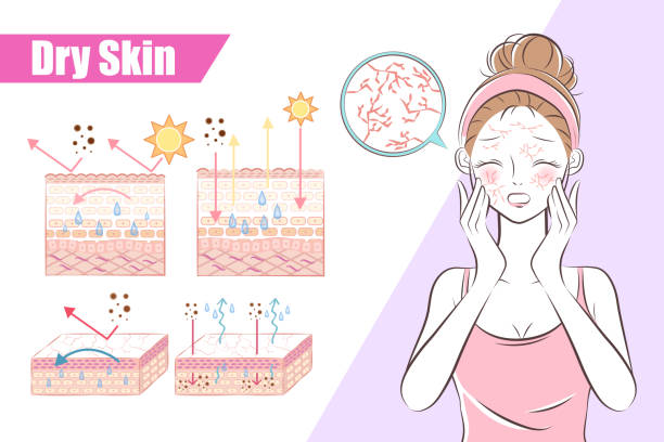 woman with dry skin concept woman with dry skin on the white background dry skin stock illustrations