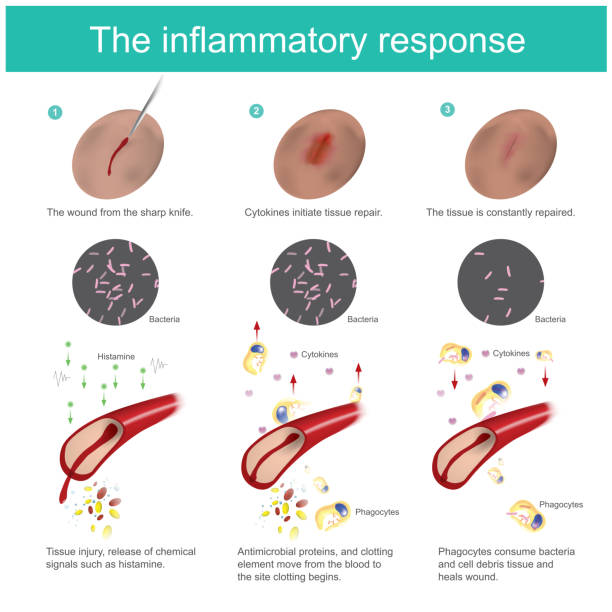 illustrazioni stock, clip art, cartoni animati e icone di tendenza di la risposta infiammatoria. - white blood cell human immune system virus cell