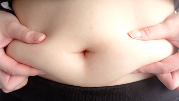 istock woman hand catching fat body belly paunch , diabetic risk factor 1014224098
