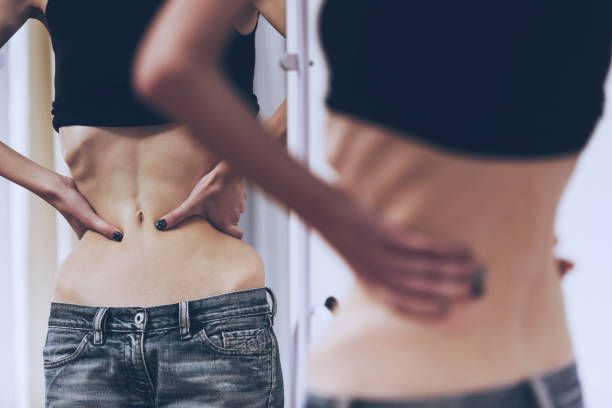 Girl with Anorexia Look in Mirror. stock photo