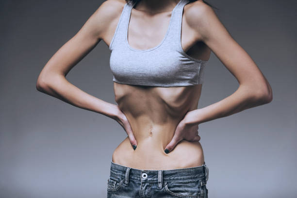 woman hold hands in belly ribs. - anorexia imagens e fotografias de stock