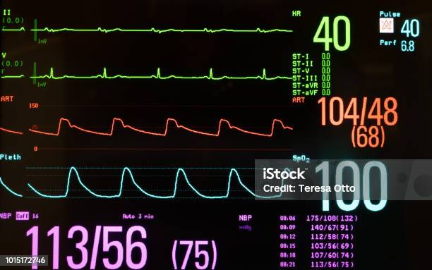 Medical Monitor Showing Bradycardia Blood Pressure And Oxygen Level Stock Photo - Download Image Now