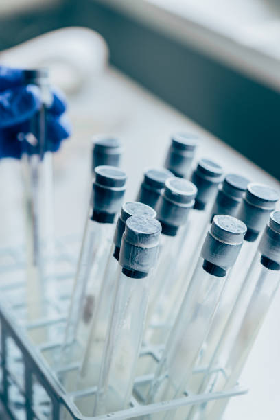 istock selective focus of flasks and hand of biologist behind in modern laboratory 1016024892