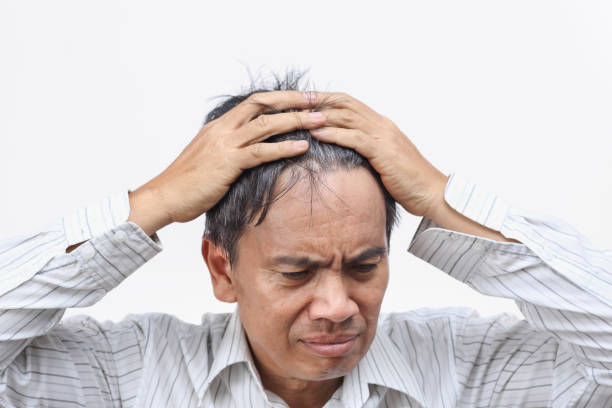 istock Baldness (hair loss) led to Mid-life Crisis 1016167888