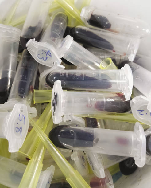 istock Biomedical waste. Micropipette plastic tips and plastic vials with blood and biological fluids. 1016307194