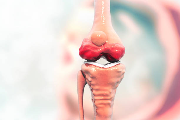 istock Anatomy of human knee joint 1016558808
