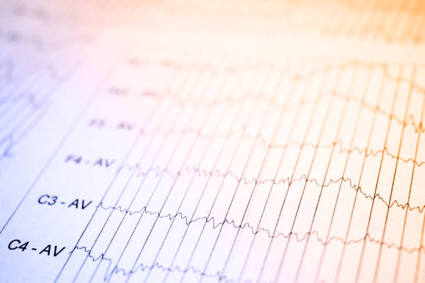 eeg elektrophysiologische monitoring-methode. eeg-welle im menschlichen gehirn, gehirnwellenmuster auf elektroenzephalogramm, eeg des kindes, erkennen probleme der elektrischen aktivität des gehirns. selektiven fokus - eeg epilepsy science electrode stock-fotos und bilder