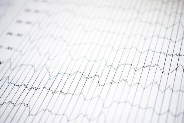 eeg elektrophysiologische monitoring-methode. eeg-welle im menschlichen gehirn, gehirnwellenmuster auf elektroenzephalogramm, eeg des kindes, erkennen probleme der elektrischen aktivität des gehirns. selektiven fokus - eeg epilepsy science electrode stock-fotos und bilder