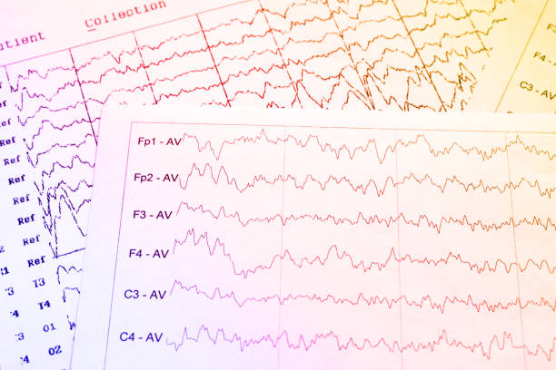eeg electrophysiological monitoring method. eeg wave in human brain, brain wave patterns on electroencephalogram, eeg of the child, detect problems in the electrical activity of the brain - eeg epilepsy science electrode imagens e fotografias de stock