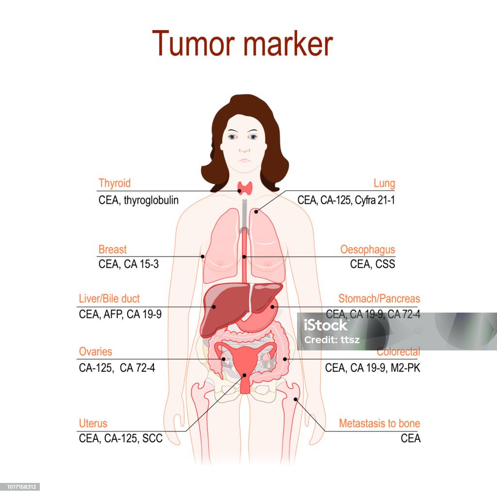 Vetores de Marcador Tumoral Ou Biomarcador Silhueta De Uma Mulher Com  Órgãos Internos e mais imagens de Biomarcador - iStock