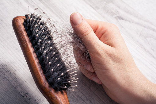 A Female Hand Pulling Bunch Of Hair Out Of Brush - Alopecia Hair Loss Concept