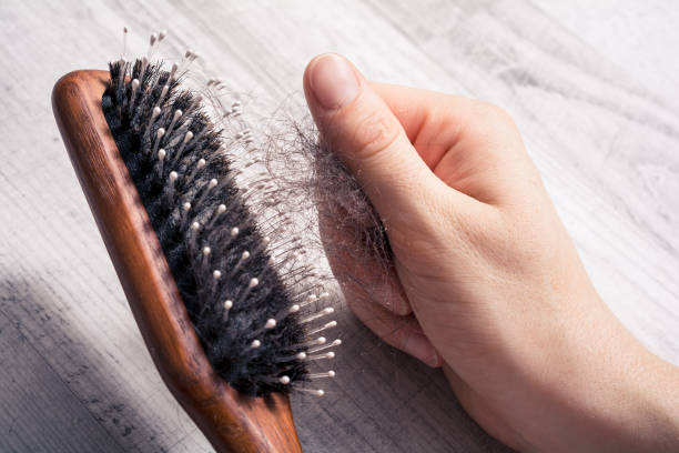 Female Hand Pulling Bunch Of Hair Out Of Brush - Alopecia Hair Loss Concept stock photo