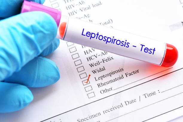 Blood sample tube for Leptospirosis test stock photo