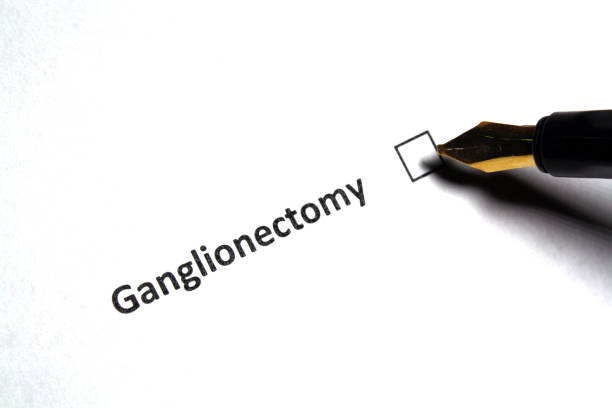 ganglionektomie - ganglion - stock snímky, obrázky a fotky