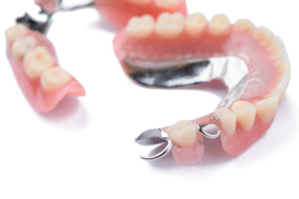 istock Close-up metal removable partial denture on white background 1018110514