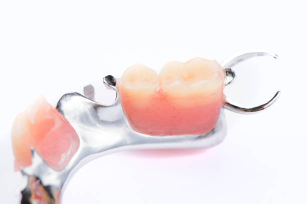 istock Close-up lower metal denture on a white background 1018110710