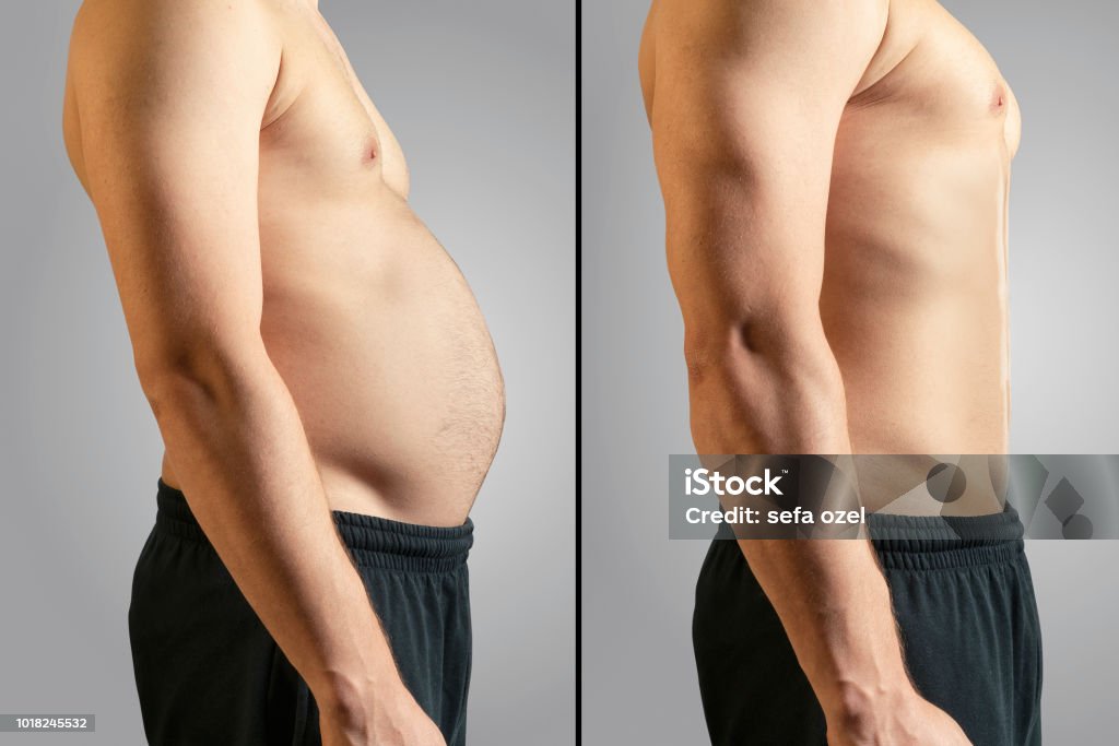 Before And After Losing Fat Overweight, Dieting, Change, Abdomen, Men Dieting Stock Photo