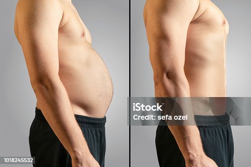 Weight Loss Before After Man Images – Browse 1,665 Stock Photos