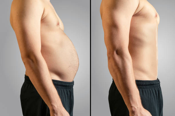 Before And After Losing Fat Overweight, Dieting, Change, Abdomen, Men fat stock pictures, royalty-free photos & images