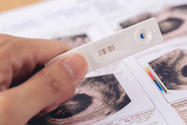 istock pregnancy test and ultrasound report. 1018318314