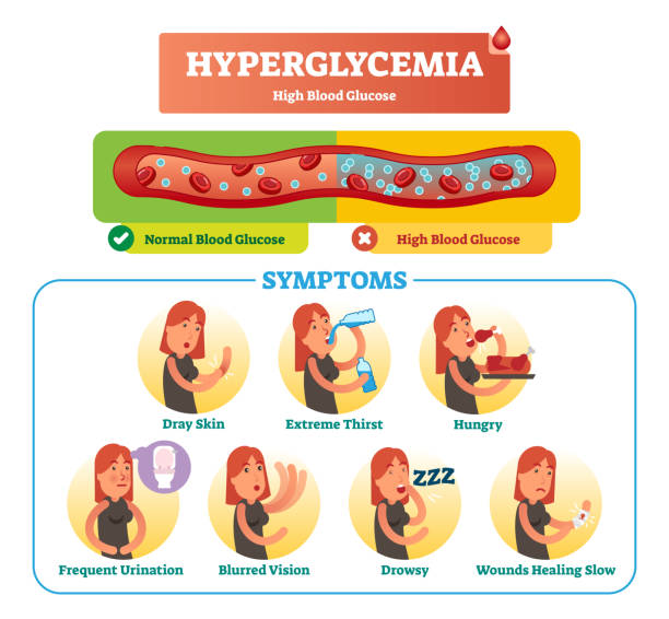 ilustraciones, imágenes clip art, dibujos animados e iconos de stock de sistema de la colección del vector ilustración de hiperglucemia. síntoma aislado, diagnóstico y señales de advertencia a la enfermedad y el desorden. alta azúcar en la sangre. - hyperglycemia