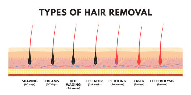 머리 제거 개념입니다. 면도, 탈모 크림, 왁 싱, 제 모기, 뽑기, 레이저 머리 제거 및 전기 분해. 머리 제거의 다른 유형의 비교 - waxing stock illustrations