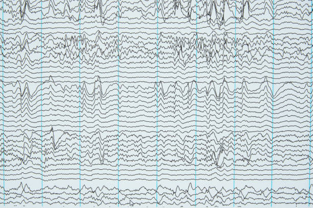 imaging della registrazione elettroencefalografica di esseri umani - eeg epilepsy science electrode foto e immagini stock