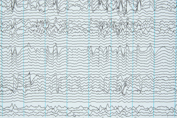 imaging of electroencephalography recording of human - eeg epilepsy science electrode imagens e fotografias de stock