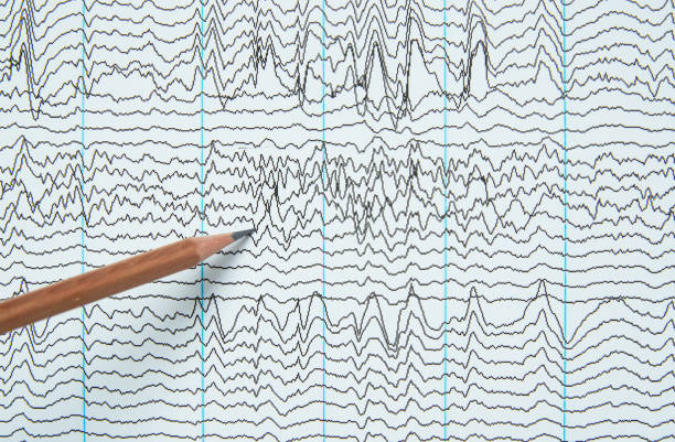 imaging della registrazione elettroencefalografica di esseri umani - eeg epilepsy science electrode foto e immagini stock