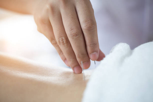 istock Traditional Chinese Medicine Treatment - Acupuncture 1018869806