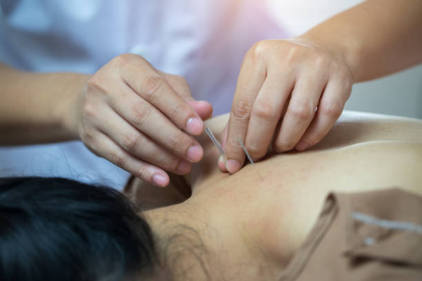 istock Traditional Chinese Medicine Treatment - Acupuncture 1018869810