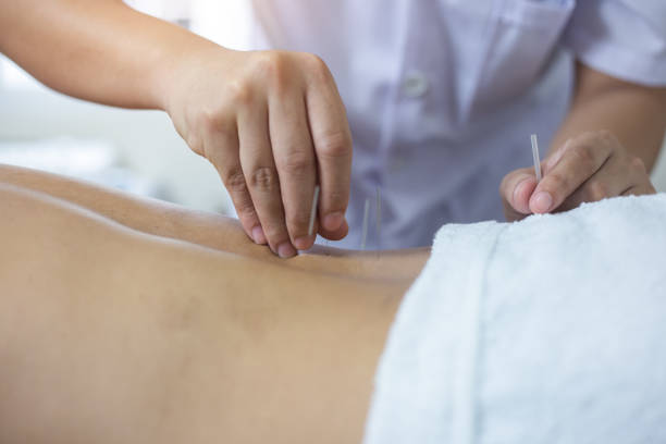 istock Traditional Chinese Medicine Treatment - Acupuncture 1018870154