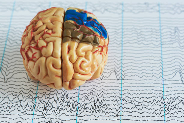 brain model on human brain wave background - eeg epilepsy science electrode imagens e fotografias de stock