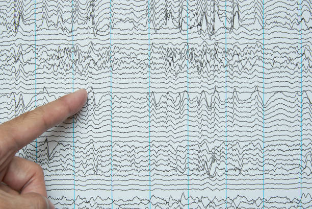 puntare all'imaging della registrazione elettroencefalografica umana - eeg epilepsy science electrode foto e immagini stock