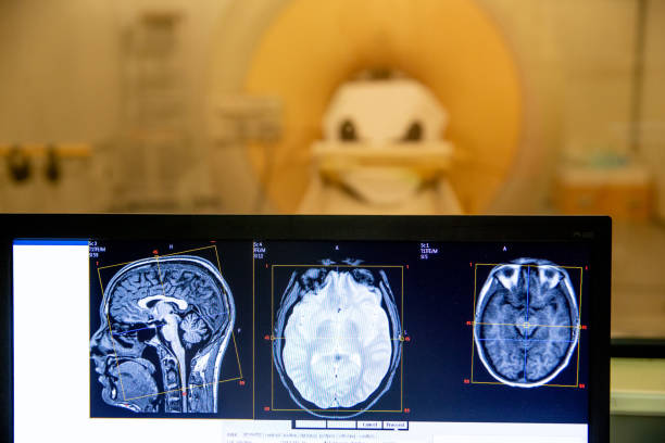 istock Magnetic Resonance Head Scan Images on Computer Monitor While Scanning 1019468628