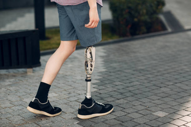 istock Disabled young man with foot prosthesis walks along the street. 1019900026