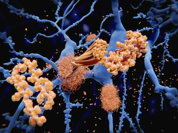 After being cleaved by the gamma and beta secretases the amyloid beta peptide, which has about 40 amino acid residues,  leaves the membrane, changes shape and aggregates into long fibrils. These fibrils form dense plaques on nerve cells, which are involved in Alzheimer's disease.