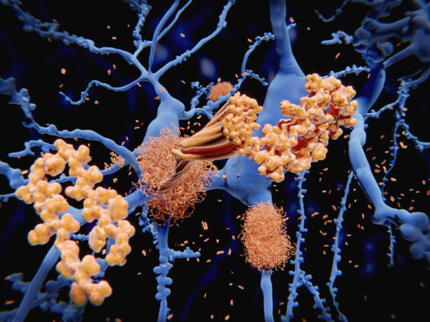 choroba alzheimera: peptyd amyloidu-beta gromadzi się w fibryle amyloidu, które budują gęste blaszki amyloidu. - peptide zdjęcia i obrazy z banku zdjęć