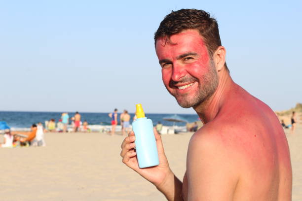 Tanning Lotion Rash 290+ Food Allergy Rash Stock Photos, Pictures & Royalty-Free Images ...