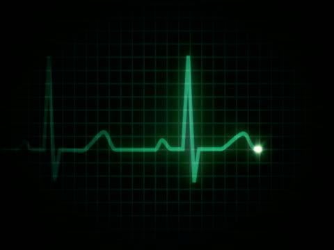 Heartbeat Line Stock Videos and Royalty-Free Footage - iStock