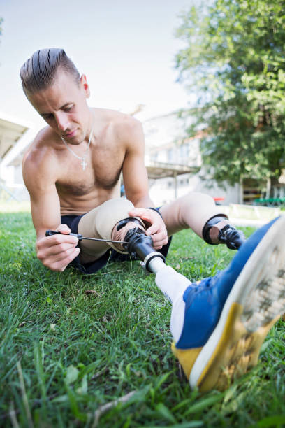 istock Maintenance of prosthetic leg 1020391012