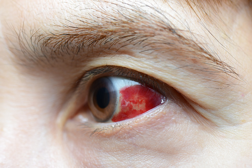 IStock