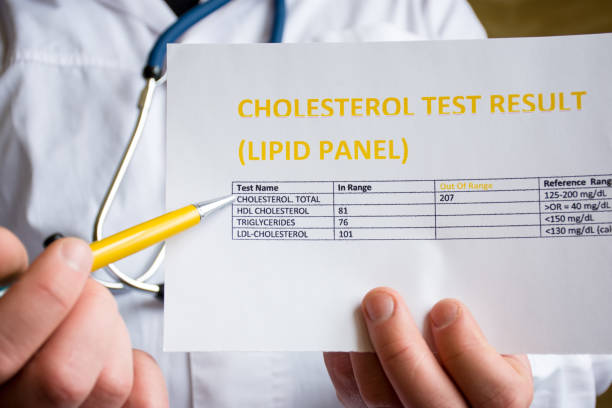 arzt zeigt patienten oder kollegen auf cholesterin test ergebnis oder lipid panel, in medizinischen weißkittel stehen. konzept-foto zur veranschaulichung von diagnose und screening von cholesterin im blut hoch oder niedrig - cholesterintest stock-fotos und bilder