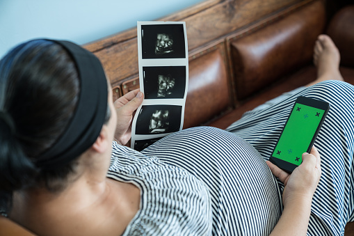 Photo of pregnant woman using mobile phone with green screen. She is wearing a striped dress and lying down on sofa. There is a ultrasound image of baby is her left hand. Shot indoor with a full frame mirrorless camera.
